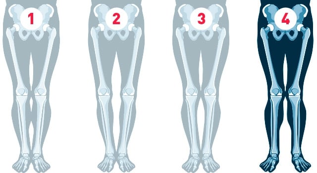 Разные типы строения ног